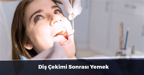 Diş Çekimi Sonrası Yemek